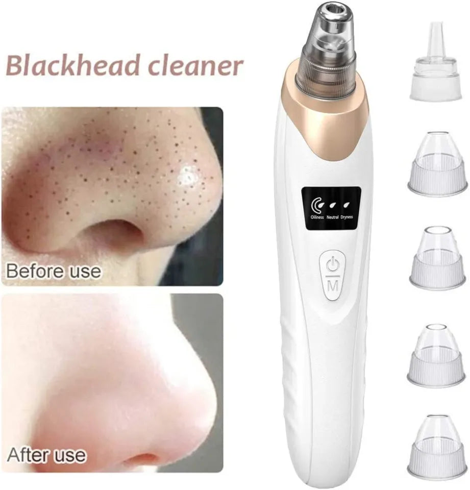 Blackhead & Dirt Remover – Deep Pore Facial Cleansing Tool ✨