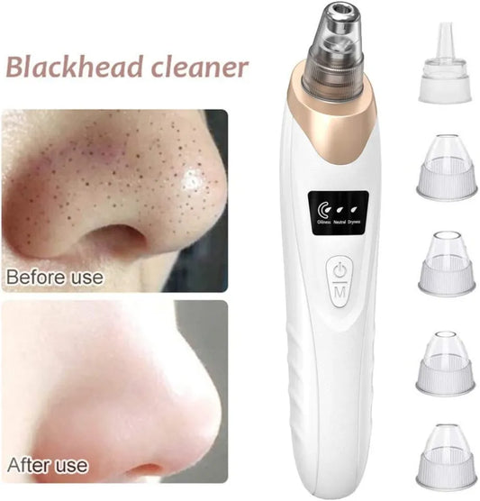 Blackhead & Dirt Remover – Deep Pore Facial Cleansing Tool ✨